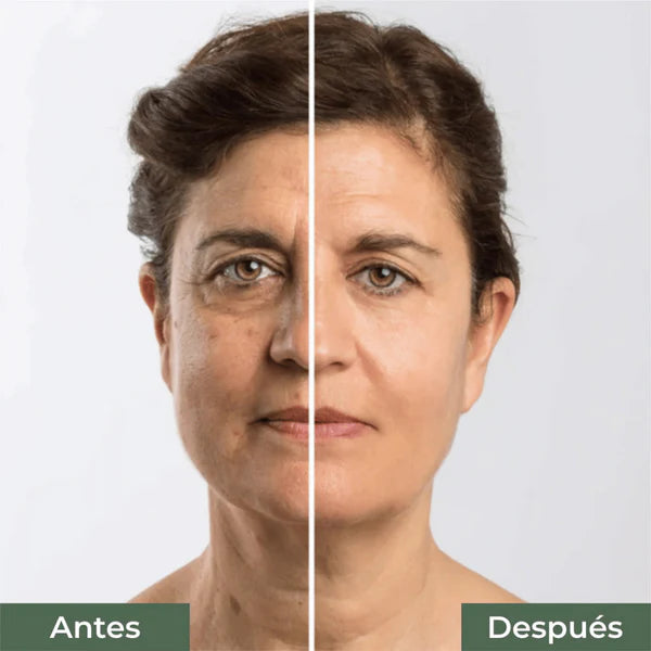 SERUM ANTI ARRUGAS